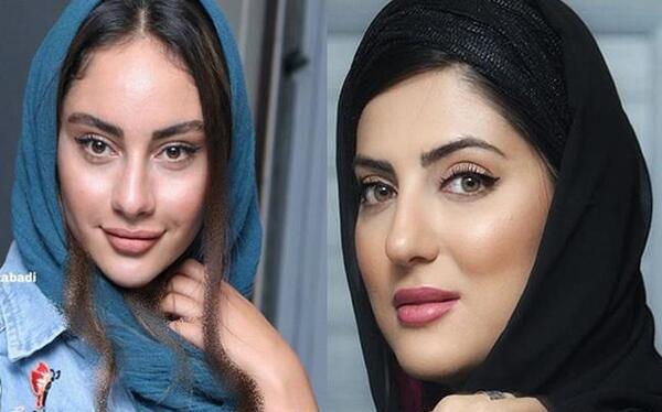 عکس لباس آهوی پیشونی سفید ۳
