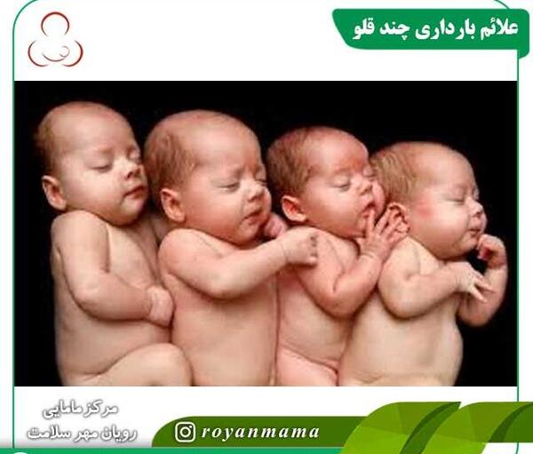 عکس نوزاد چند قلو