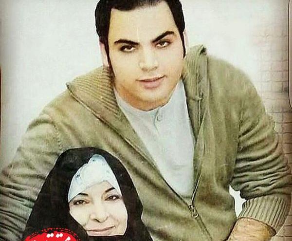 عکس احسان علیخانی قبل از کاشت مو