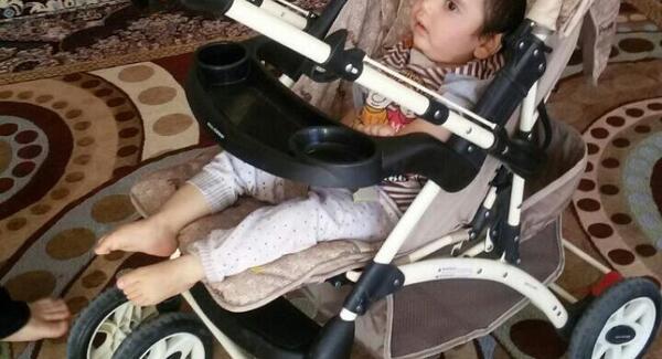 عکس نوزاد فلج مغزی