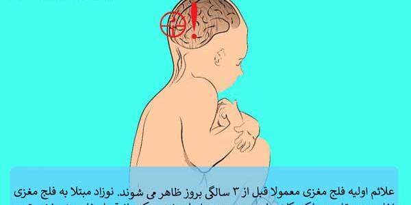 عکس نوزاد فلج مغزی