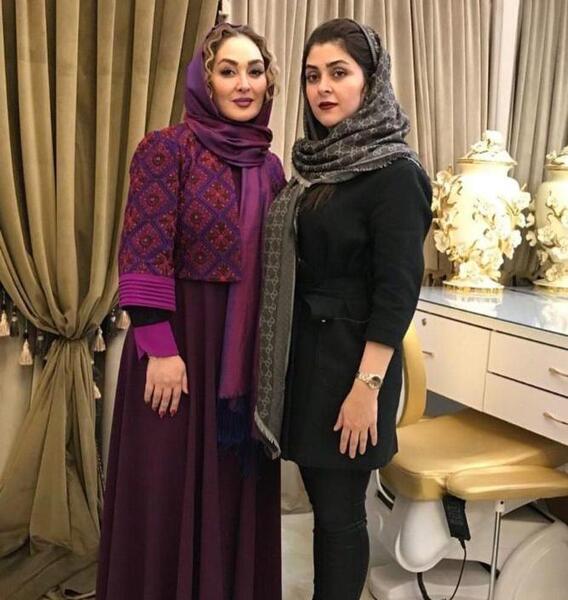 عکس مدل مانتو شیک و باکلاس اینستاگرام