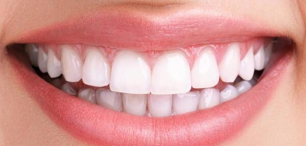 عکس طراحی لبخند