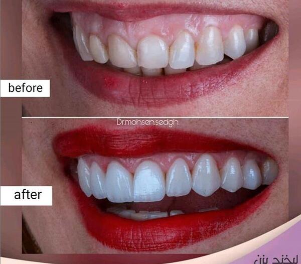 عکس طراحی لبخند
