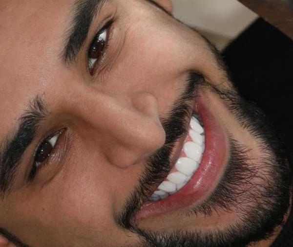 عکس طراحی لبخند