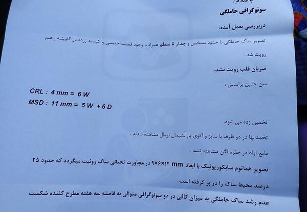 عکس نوشته صدای قلب نی نی