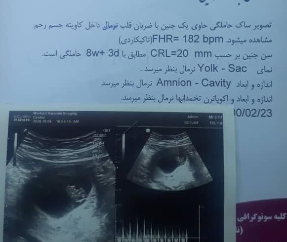 عکس نوشته صدای قلب نی نی