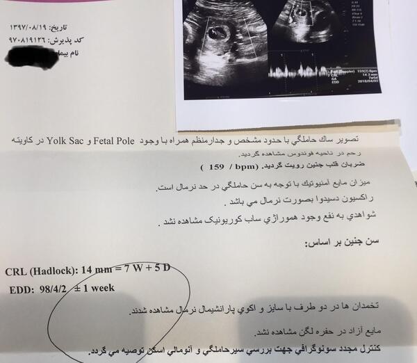 عکس نوشته صدای قلب نی نی