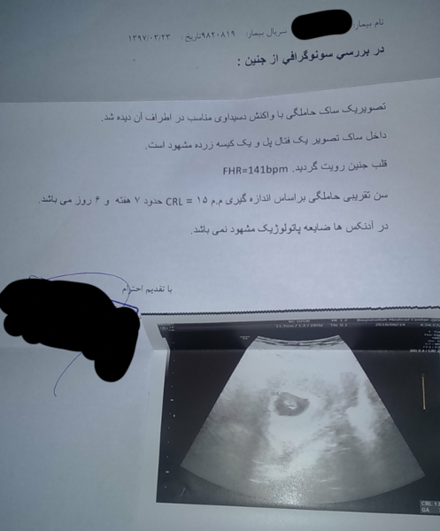 عکس نوشته صدای قلب نی نی