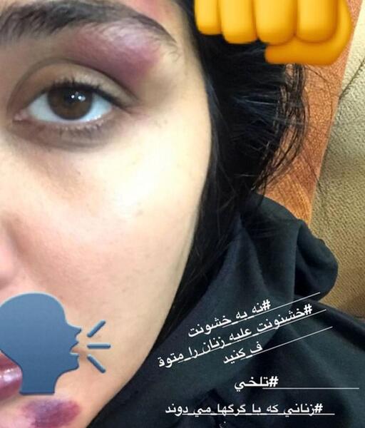 عکس مریم وحشتناک