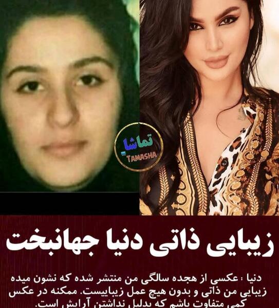 عکس قبل عمل دنیا جهانبخت