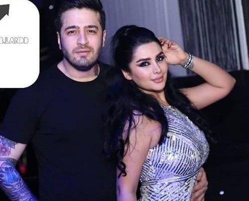 عکس قبل عمل دنیا جهانبخت
