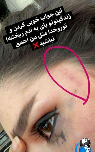 عکس قبل عمل دنیا جهانبخت