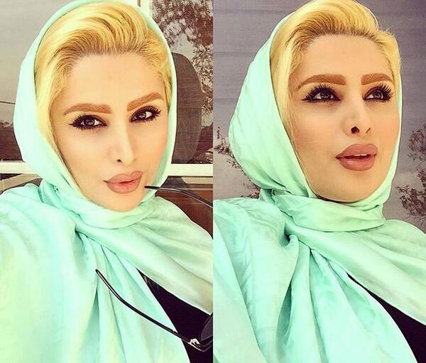 عکس قبل عمل دنیا جهانبخت