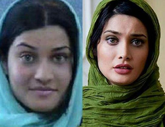 عکس تینا اخوندتبار قبل از عمل زیبایی