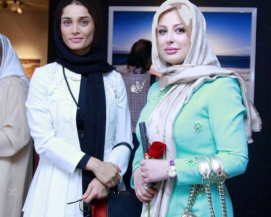 عکس تینا اخوندتبار قبل از عمل زیبایی