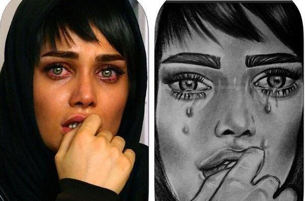عکس تینا اخوندتبار قبل از عمل زیبایی