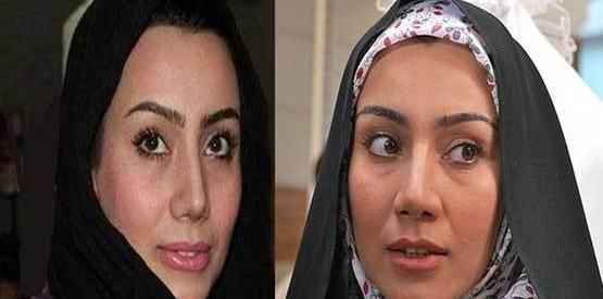 عکس تینا اخوندتبار قبل از عمل زیبایی