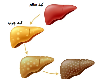 عکس کبد انسان سالم