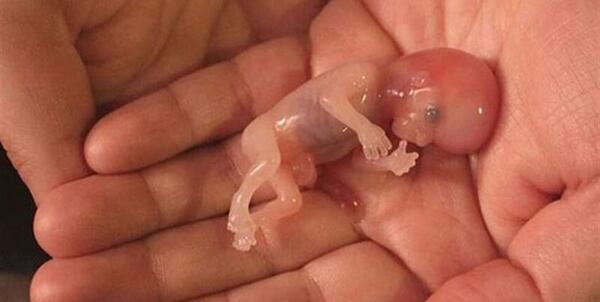 عکس بچه چهار ماهه در شکم مادر