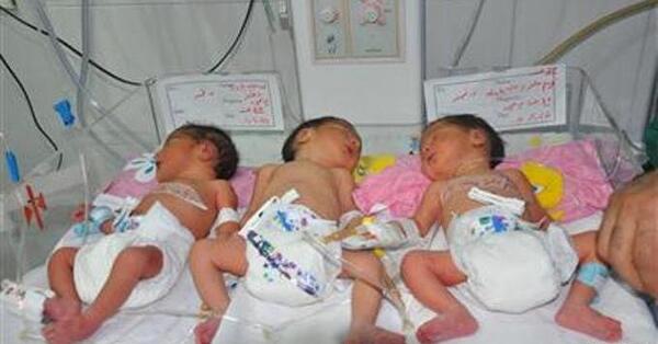 عکس بچه چهار ماهه در شکم مادر