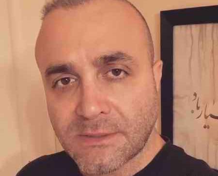 عکس سینا سرلک قبل از عمل بینی