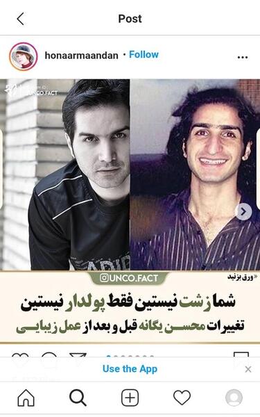 عکس یگانه قبل عمل