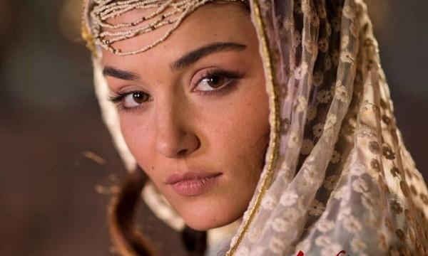 عکس زشت هانده ارچل