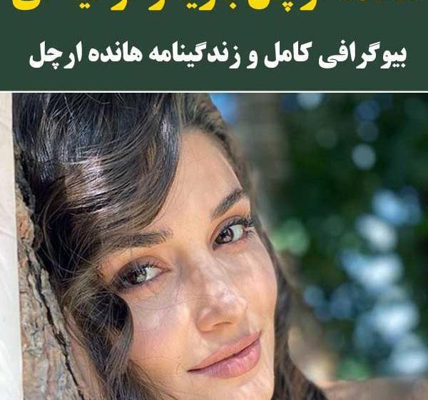 عکس زشت هانده ارچل