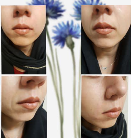 عکس فاطمه بابایی
