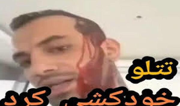 عکس تتلو خودکشی کرد