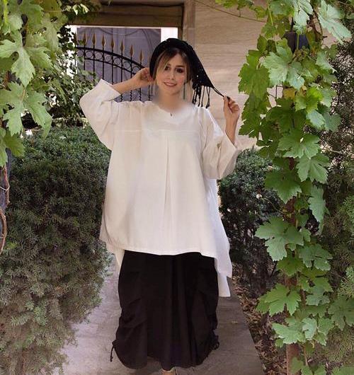 عکس بارداری سپیده بزمی پور