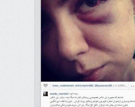 عکس لو رفته آزاده نامداری در خارج