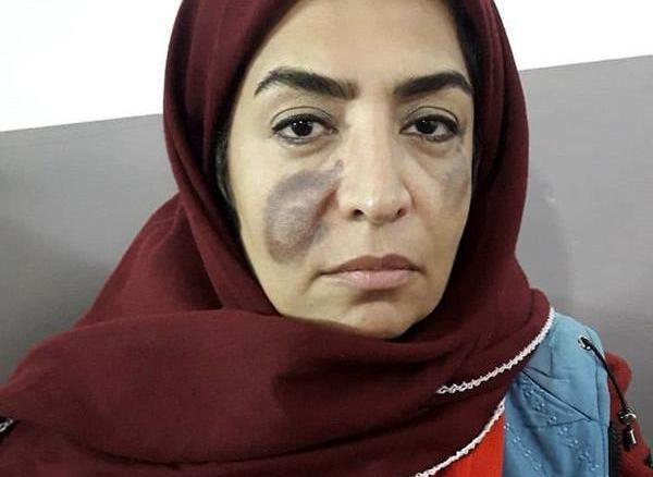 عکس ریحانه تیموری
