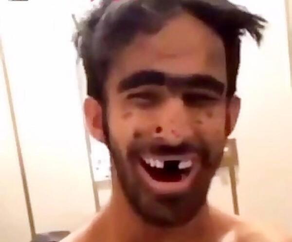 عکس قیافه زشت پسر