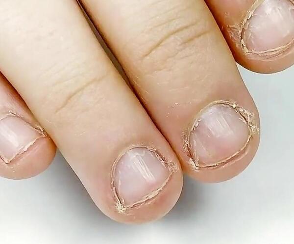 عکس ایده لاک زدن ناخن کوتاه