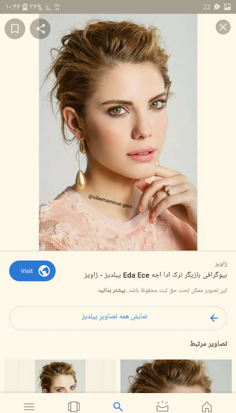 عکس ییلدیز قبل عمل زیبایی