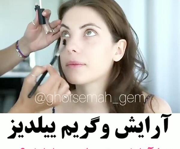 عکس ییلدیز قبل عمل زیبایی