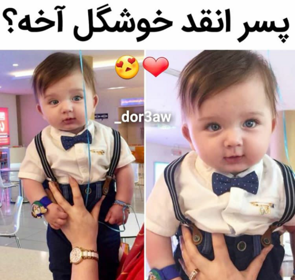 عکس نوزاد جیگر