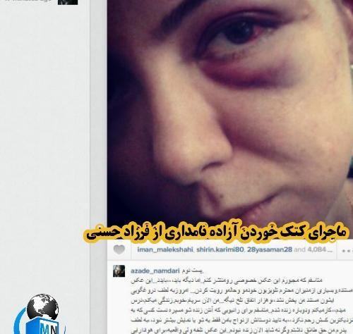 عکس صورت کتک خورده آزاده نامداری توسط فرزاد حسنی
