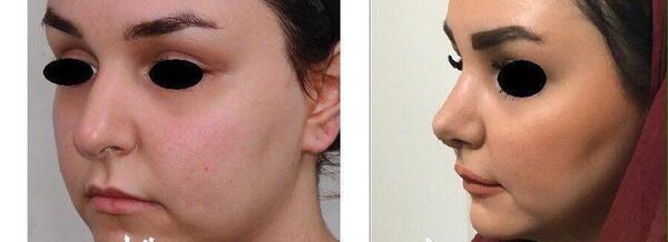 عکس ابوالفضل زارعی
