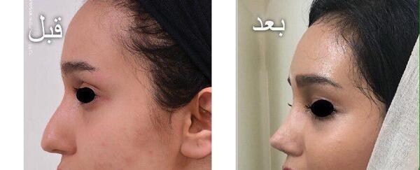 عکس ابوالفضل زارعی