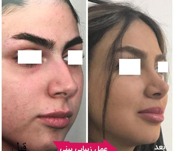 عکس ابوالفضل زارعی