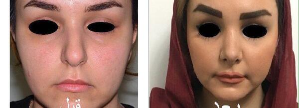 عکس ابوالفضل زارعی