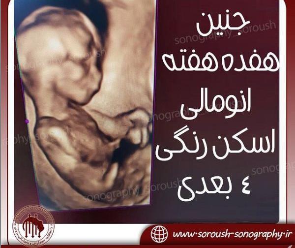 عکس سه بعدی جنین 18 هفته