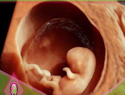 عکس سه بعدی جنین 18 هفته