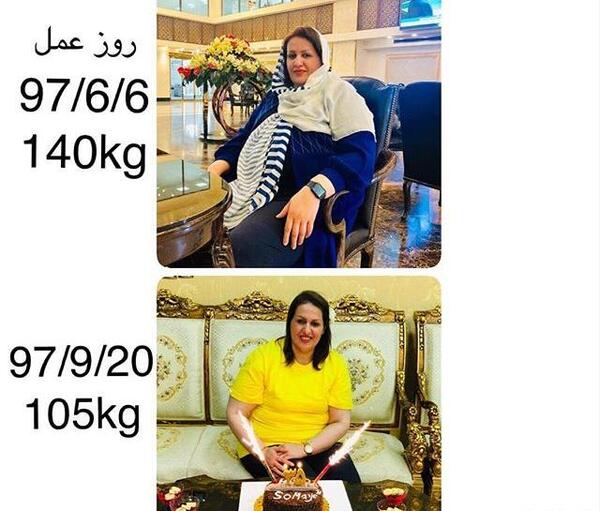 عکسهای زلیخا قبل از عمل جراحی