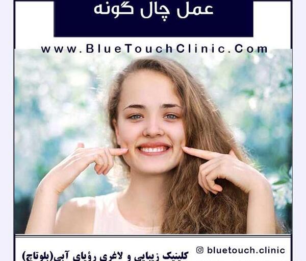 عکس چال لبخند