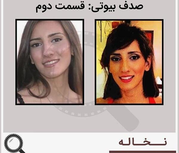 عکس صدف بیوتی قبل عمل