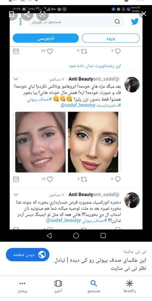 عکس صدف بیوتی قبل عمل